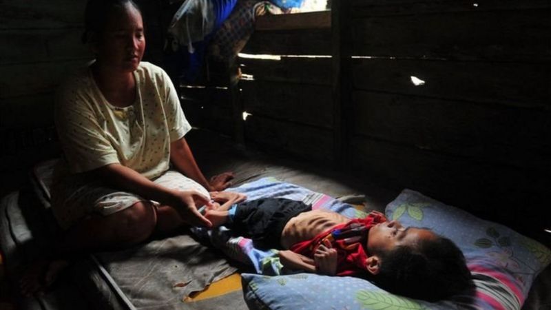 PBB Perkirakan COVID-19 Memicu 7 Juta Anak Stunting dan 180.000