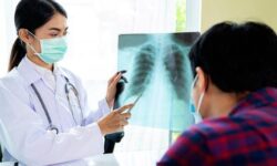 Menteri Budi Minta 90% Penderita TBC Terdeteksi di 2024