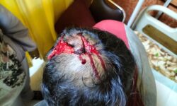 Kepala Arya Tri Putra Disambar Buaya Muara Sangatta