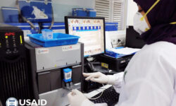 USAID Bantu Pendanaan Pencegahan TBC Rp23 Miliar
